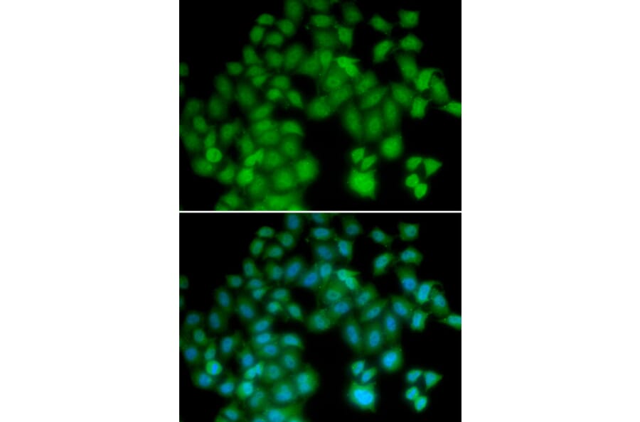 Immunofluorescence - Anti-TMSB4X Antibody (A5438) - Antibodies.com
