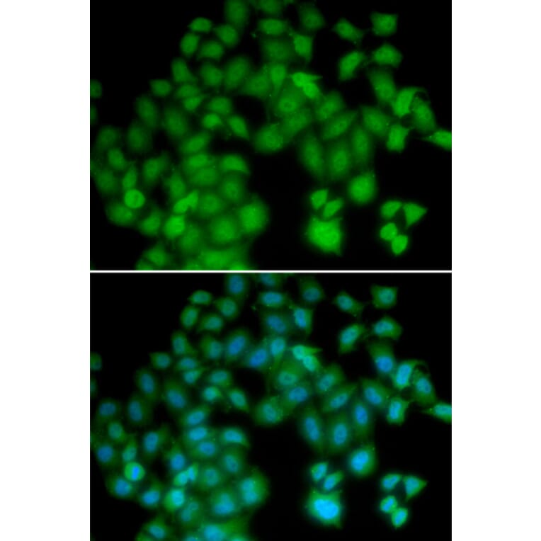 Immunofluorescence - Anti-TMSB4X Antibody (A5438) - Antibodies.com