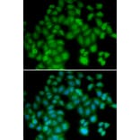 Immunofluorescence - Anti-TMSB4X Antibody (A5438) - Antibodies.com