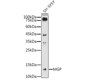 Western Blot - Anti-MGP Antibody (A14759) - Antibodies.com