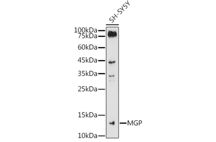 Western Blot - Anti-MGP Antibody (A14759) - Antibodies.com