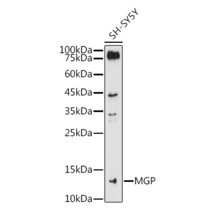 Western Blot - Anti-MGP Antibody (A14759) - Antibodies.com