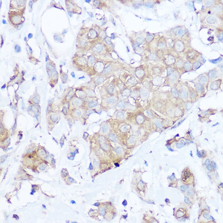 Immunohistochemistry - Anti-MGP Antibody (A14759) - Antibodies.com