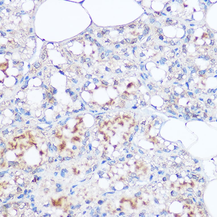 Immunohistochemistry - Anti-MGP Antibody (A14759) - Antibodies.com