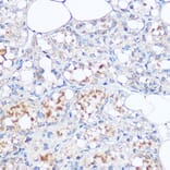 Immunohistochemistry - Anti-MGP Antibody (A14759) - Antibodies.com