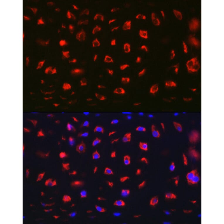 Immunofluorescence - Anti-MGP Antibody (A14759) - Antibodies.com