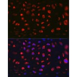 Immunofluorescence - Anti-MGP Antibody (A14759) - Antibodies.com