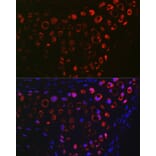 Immunofluorescence - Anti-MGP Antibody (A14759) - Antibodies.com