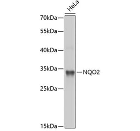 Western Blot - Anti-NQO2 Antibody (A14760) - Antibodies.com