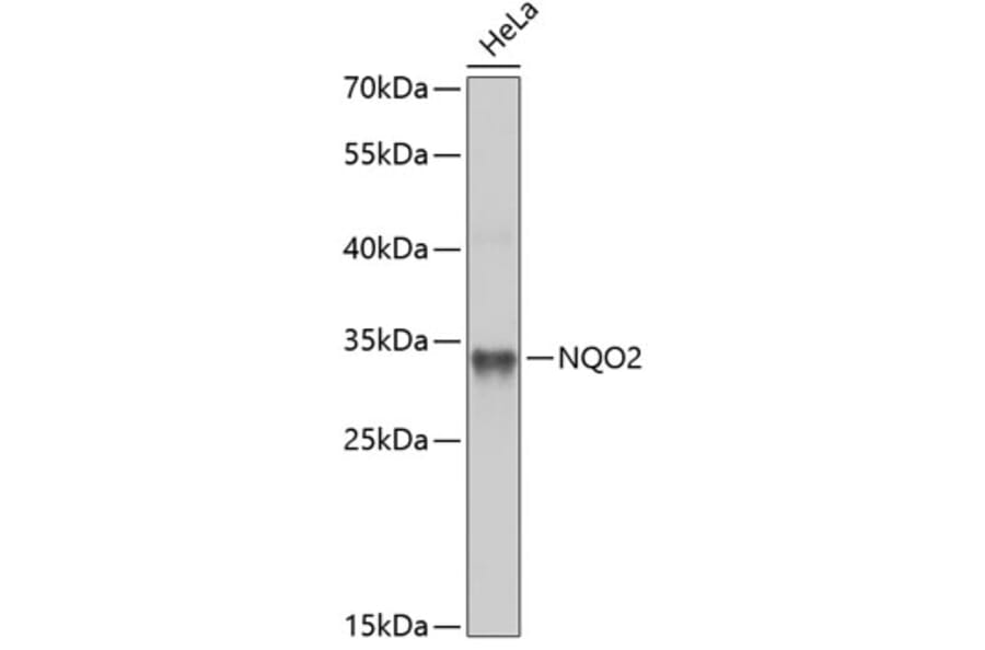 Western Blot - Anti-NQO2 Antibody (A14760) - Antibodies.com