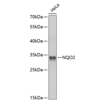 Western Blot - Anti-NQO2 Antibody (A14760) - Antibodies.com