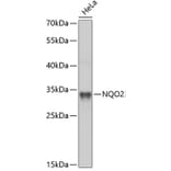 Western Blot - Anti-NQO2 Antibody (A14760) - Antibodies.com