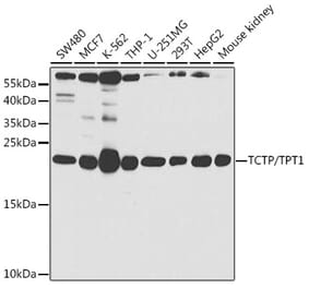 Western Blot - Anti-TCTP Antibody (A14761) - Antibodies.com