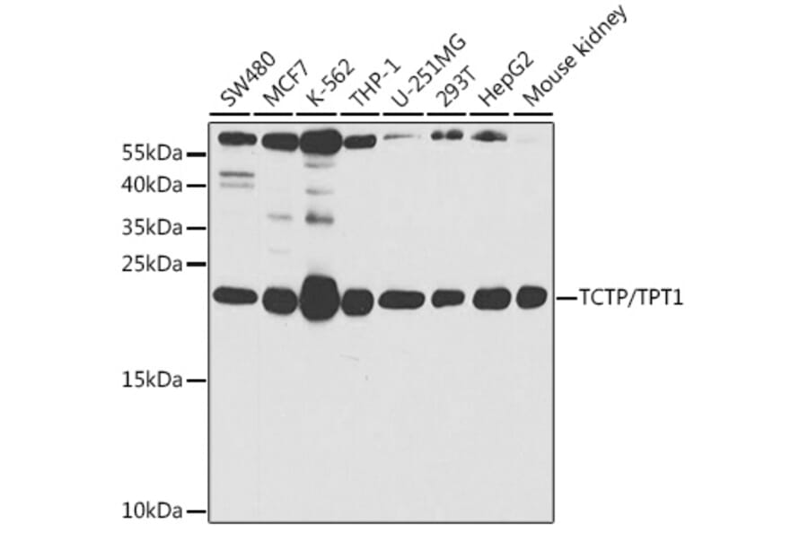 Western Blot - Anti-TCTP Antibody (A14761) - Antibodies.com