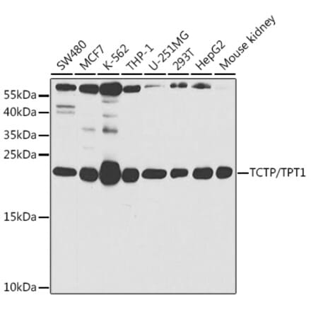 Western Blot - Anti-TCTP Antibody (A14761) - Antibodies.com