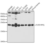 Western Blot - Anti-TCTP Antibody (A14761) - Antibodies.com