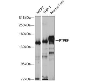 Western Blot - Anti-LAR Antibody (A14762) - Antibodies.com