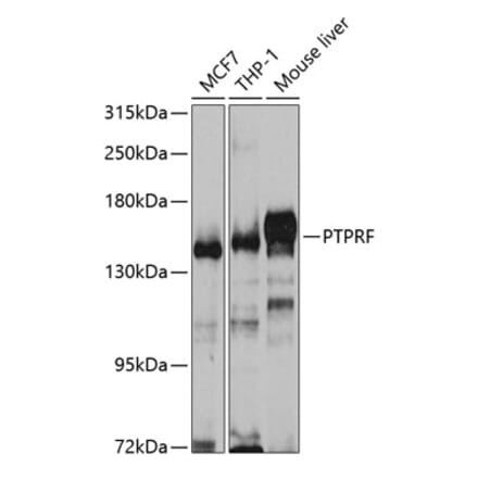 Western Blot - Anti-LAR Antibody (A14762) - Antibodies.com