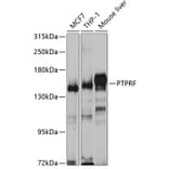 Western Blot - Anti-LAR Antibody (A14762) - Antibodies.com