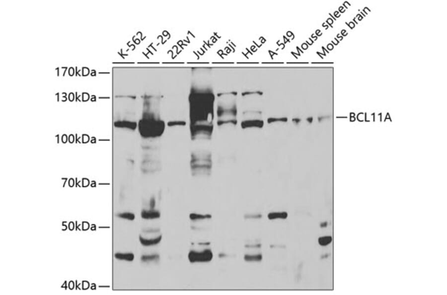 Western Blot - Anti-BCL11A Antibody (A5445) - Antibodies.com