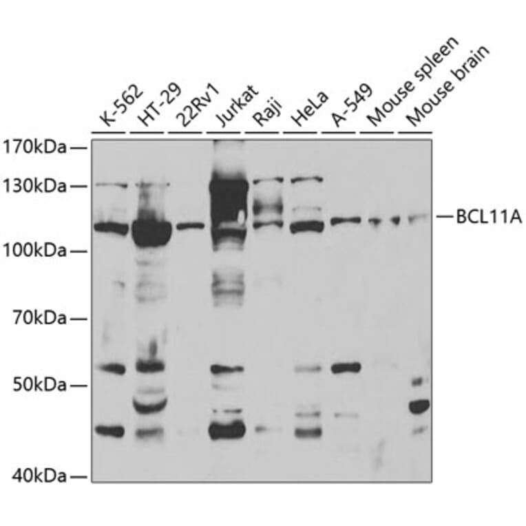 Western Blot - Anti-BCL11A Antibody (A5445) - Antibodies.com
