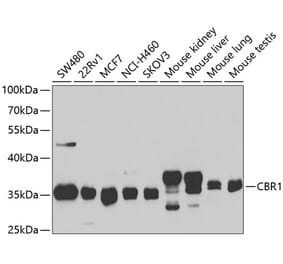 Western Blot - Anti-CBR1 Antibody (A14764) - Antibodies.com