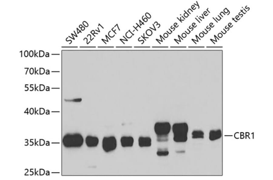Western Blot - Anti-CBR1 Antibody (A14764) - Antibodies.com
