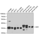 Western Blot - Anti-CBR1 Antibody (A14764) - Antibodies.com