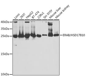 Western Blot - Anti-ERAB Antibody (A14766) - Antibodies.com