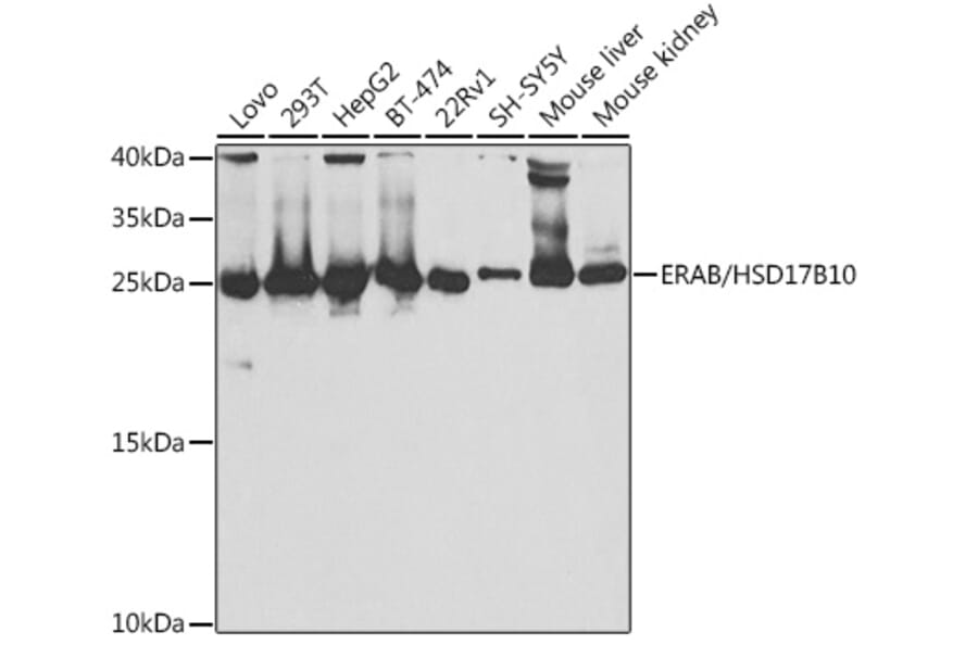 Western Blot - Anti-ERAB Antibody (A14766) - Antibodies.com