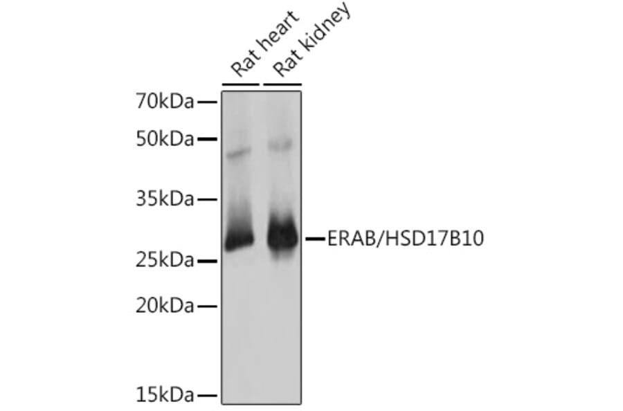 Western Blot - Anti-ERAB Antibody (A14766) - Antibodies.com