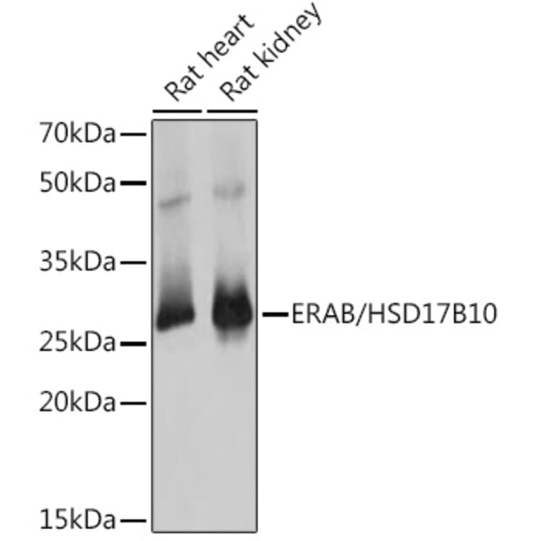 Western Blot - Anti-ERAB Antibody (A14766) - Antibodies.com