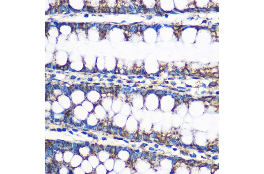 Immunohistochemistry - Anti-ERAB Antibody (A14766) - Antibodies.com