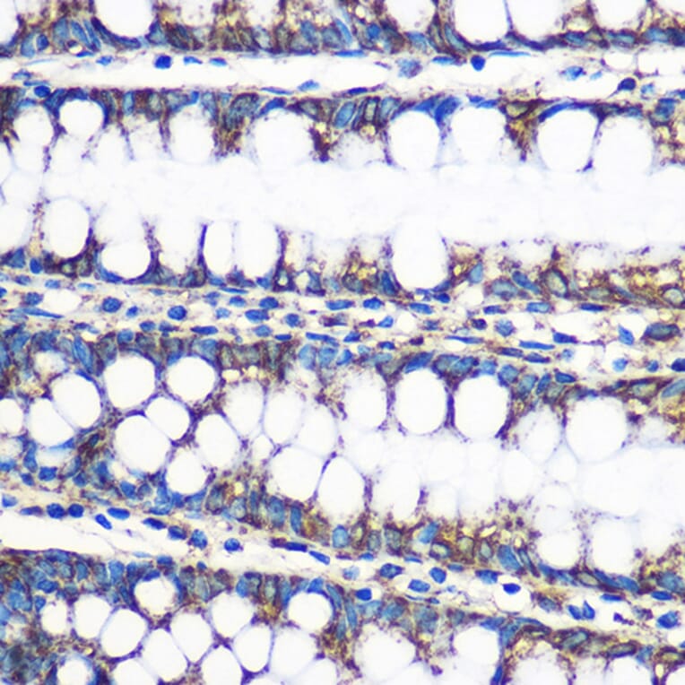 Immunohistochemistry - Anti-ERAB Antibody (A14766) - Antibodies.com