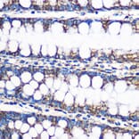 Immunohistochemistry - Anti-ERAB Antibody (A14766) - Antibodies.com