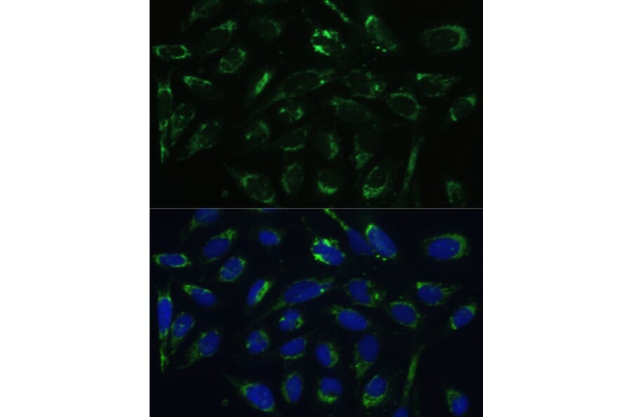 Immunofluorescence - Anti-ERAB Antibody (A14766) - Antibodies.com