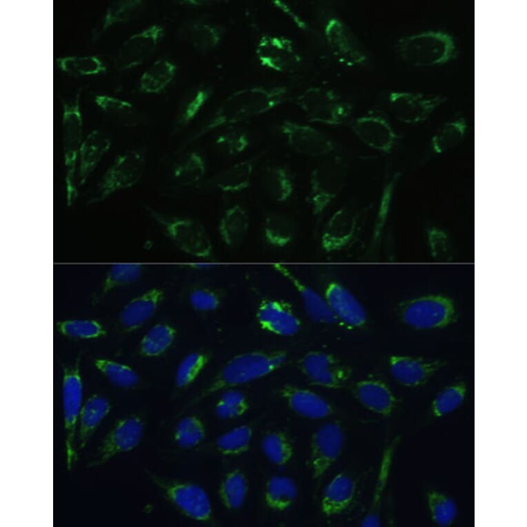 Immunofluorescence - Anti-ERAB Antibody (A14766) - Antibodies.com