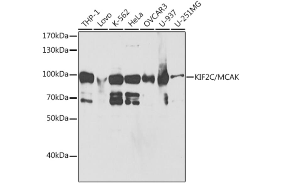 Western Blot - Anti-MCAK Antibody (A14767) - Antibodies.com