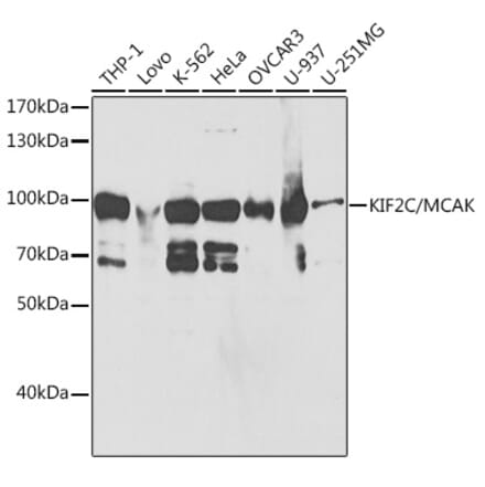 Western Blot - Anti-MCAK Antibody (A14767) - Antibodies.com