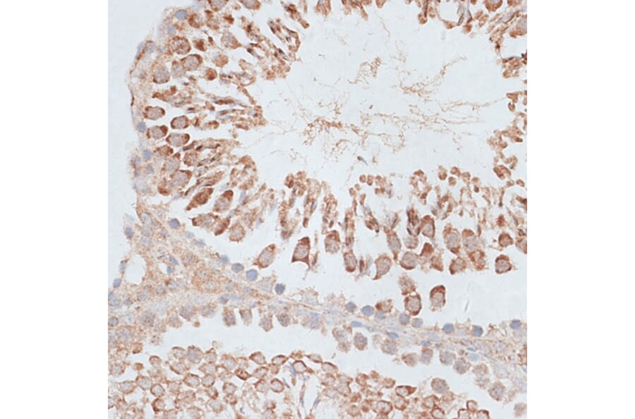 Immunohistochemistry - Anti-MCAK Antibody (A14767) - Antibodies.com