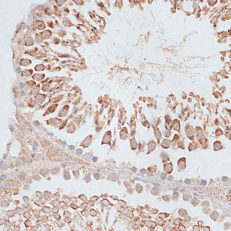 Immunohistochemistry - Anti-MCAK Antibody (A14767) - Antibodies.com