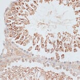 Immunohistochemistry - Anti-MCAK Antibody (A14767) - Antibodies.com