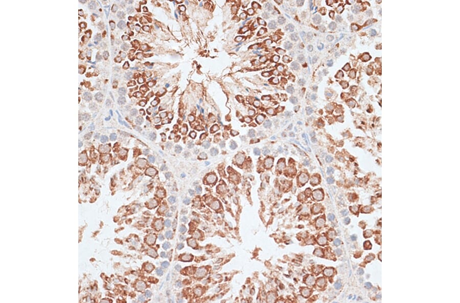Immunohistochemistry - Anti-MCAK Antibody (A14767) - Antibodies.com