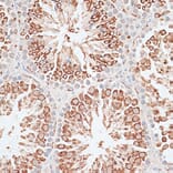 Immunohistochemistry - Anti-MCAK Antibody (A14767) - Antibodies.com