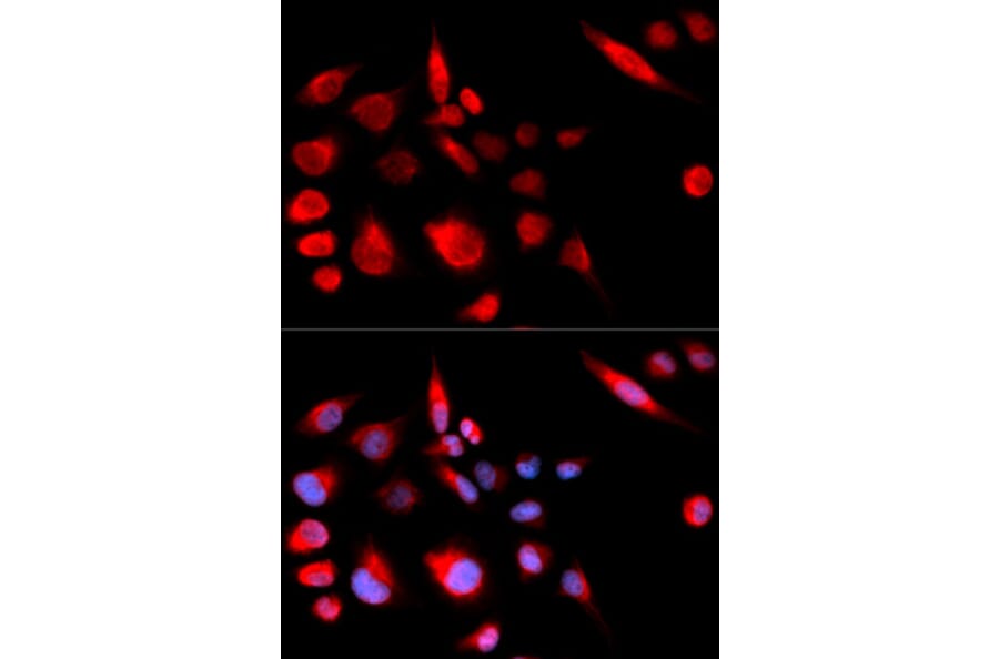 Immunofluorescence - Anti-MCAK Antibody (A14767) - Antibodies.com