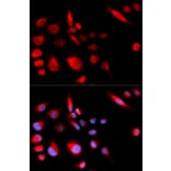 Immunofluorescence - Anti-MCAK Antibody (A14767) - Antibodies.com