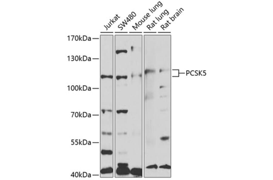 Western Blot - Anti-PCSK5 Antibody (A14768) - Antibodies.com