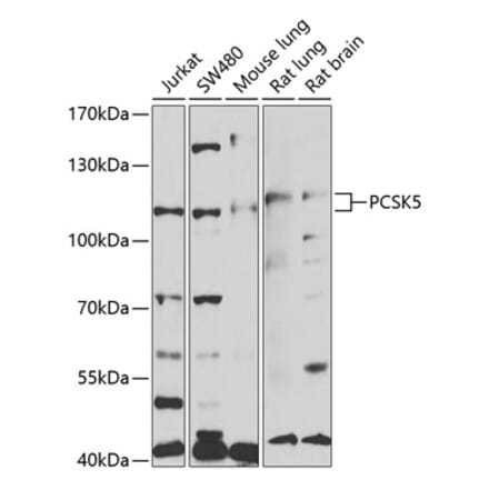 Western Blot - Anti-PCSK5 Antibody (A14768) - Antibodies.com