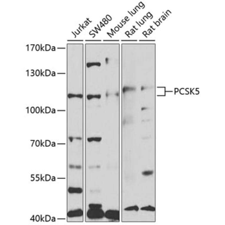 Western Blot - Anti-PCSK5 Antibody (A14768) - Antibodies.com