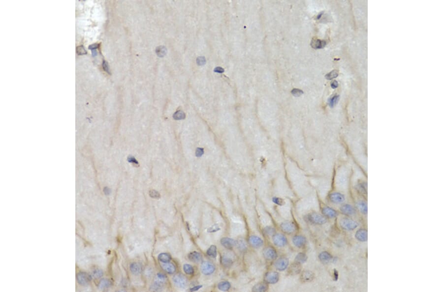 Immunohistochemistry - Anti-PSMB10/MECL1 Antibody (A14770) - Antibodies.com